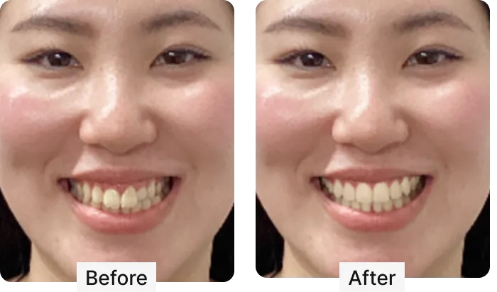 BeforeとAfterの写真